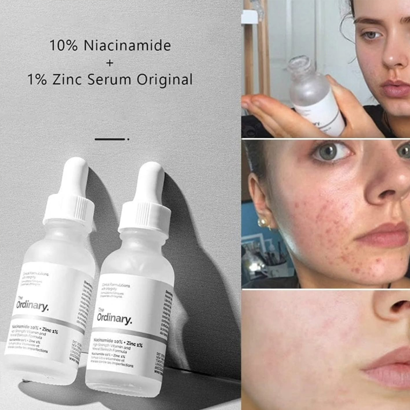 The Ordinary Niacinamide 10% + - Luxury Skincare Brands recensie en prijs